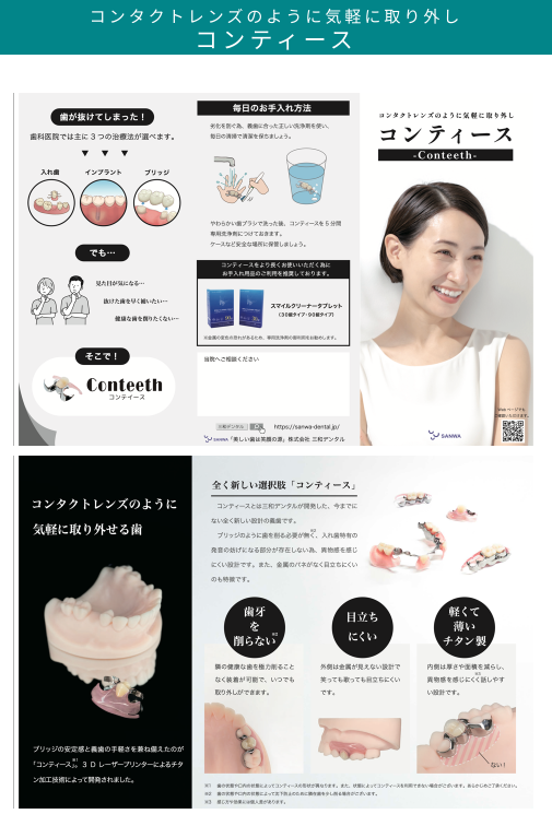 コンタクトレンズのように気軽に取り外しコンティース